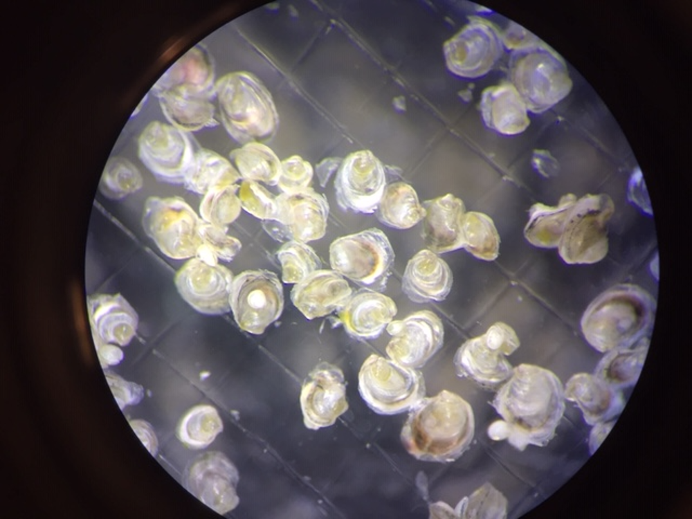 Juvenile Pacific oyster spat viewed under the microscope. (Images courtesy of Amy Chan)