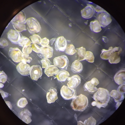 Juvenile Pacific oyster spat viewed under the microscope. (Images courtesy of Amy Chan)